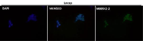 Anti-Androgen Receptor AR Rabbit Monoclonal Antibody Boster Bio