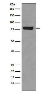 Anti-Androgen Receptor (AR-V7 specific) Rabbit Monoclonal Antibody Boster Bio