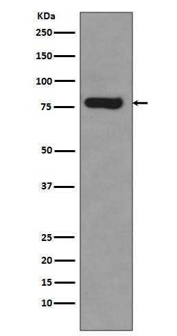 Anti-Androgen Receptor (AR-V7 specific) Rabbit Monoclonal Antibody Boster Bio