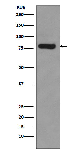 Anti-Androgen Receptor (AR-V7 specific) Rabbit Monoclonal Antibody Boster Bio