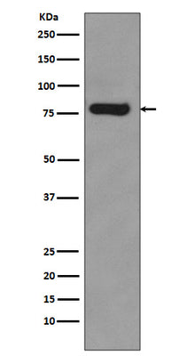 Anti-Androgen Receptor (AR-V7 specific) Rabbit Monoclonal Antibody Boster Bio