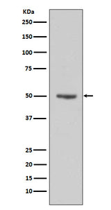 Anti-Cyclin E1 CCNE1 Rabbit Monoclonal Antibody Boster Bio