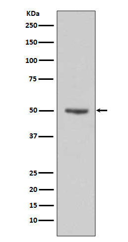 Anti-Cyclin E1 CCNE1 Rabbit Monoclonal Antibody Boster Bio