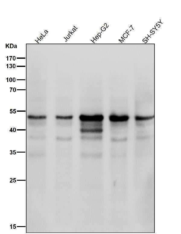 Anti-Cyclin E1 CCNE1 Rabbit Monoclonal Antibody Boster Bio