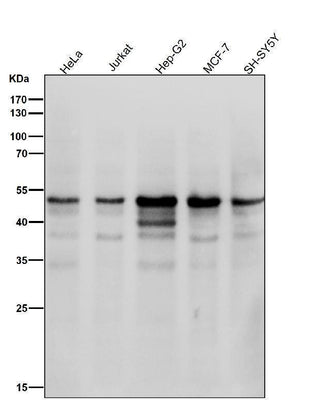 Anti-Cyclin E1 CCNE1 Rabbit Monoclonal Antibody Boster Bio
