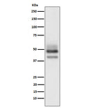 Anti-SKP2 Rabbit Monoclonal Antibody Boster Bio