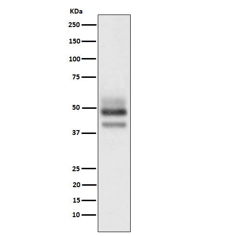 Anti-SKP2 Rabbit Monoclonal Antibody Boster Bio