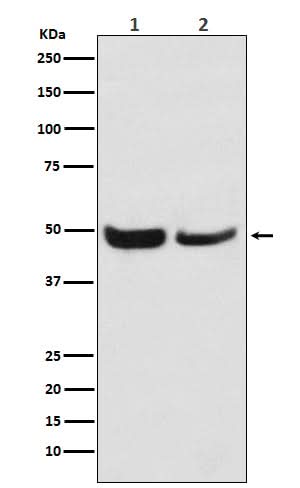 Anti-SKP2 Monoclonal Antibody Boster Bio