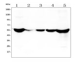 Anti-ALDH2 Antibody Picoband® (monoclonal, 5G7 Boster Bio