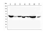 Anti-ALDH2 Antibody Picoband®(monoclonal, 6H2 Boster Bio
