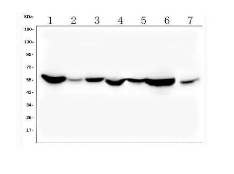 Anti-ALDH2 Antibody Picoband®(monoclonal, 6H2 Boster Bio