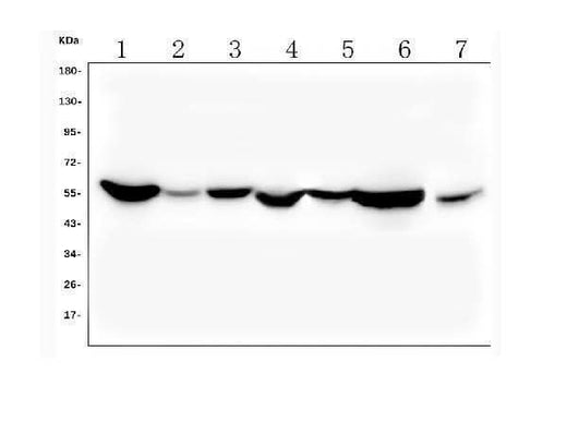 Anti-ALDH2 Antibody Picoband®(monoclonal, 6H2 Boster Bio