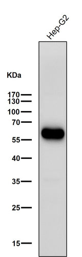 Anti-ALDH2 Rabbit Monoclonal Antibody Boster Bio