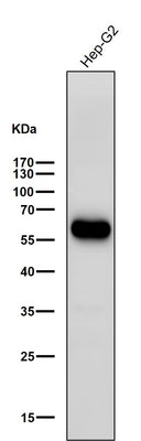 Anti-ALDH2 Rabbit Monoclonal Antibody Boster Bio