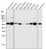 Anti-ALDH2 Monoclonal Antibody Boster Bio
