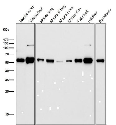 Anti-ALDH2 Monoclonal Antibody Boster Bio