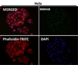 Anti-ZEB1 Monoclonal Antibody Boster Bio