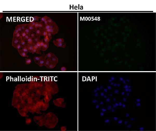 Anti-ZEB1 Monoclonal Antibody Boster Bio