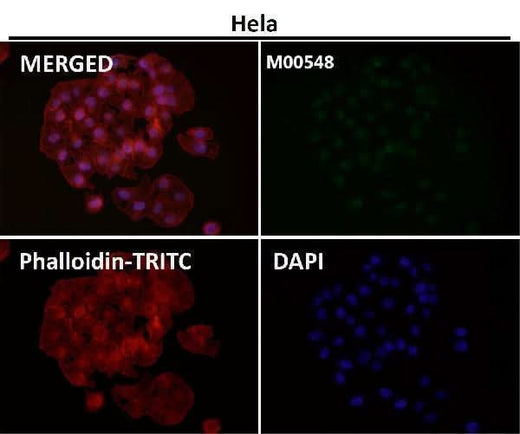 Anti-ZEB1 Monoclonal Antibody Boster Bio