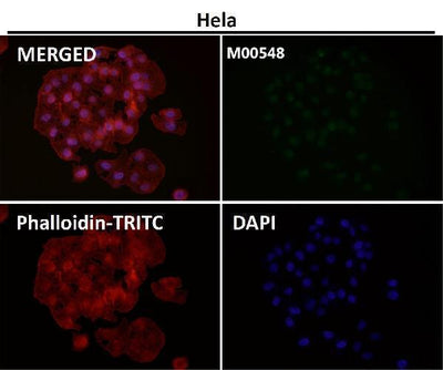 Anti-ZEB1 Monoclonal Antibody Boster Bio