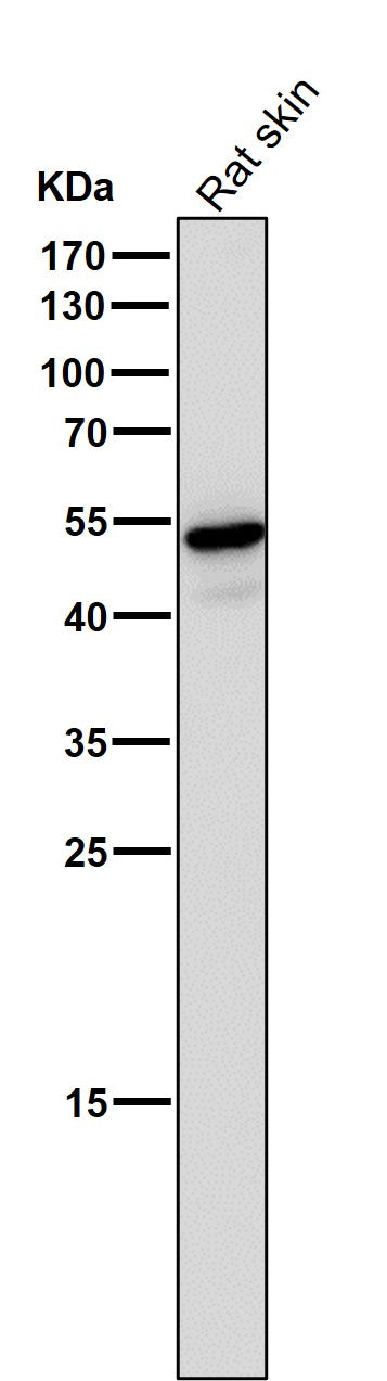 Anti-Wnt5a Rabbit Monoclonal Antibody Boster Bio