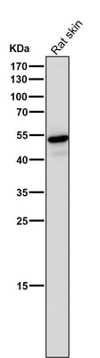 Anti-Wnt5a Rabbit Monoclonal Antibody Boster Bio