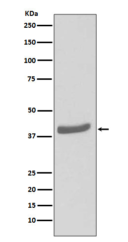 Anti-CDK7 Rabbit Monoclonal Antibody Boster Bio