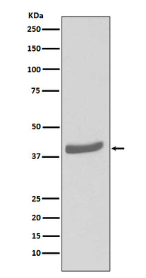 Anti-CDK7 Rabbit Monoclonal Antibody Boster Bio