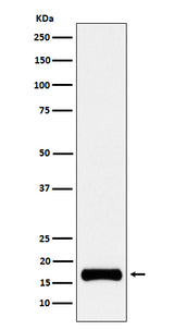 Anti-ISG15 Rabbit Monoclonal Antibody Boster Bio