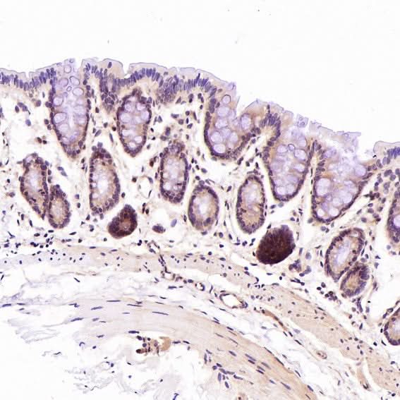 Anti-CD45 PTPRC Rabbit Monoclonal Antibody Boster Bio