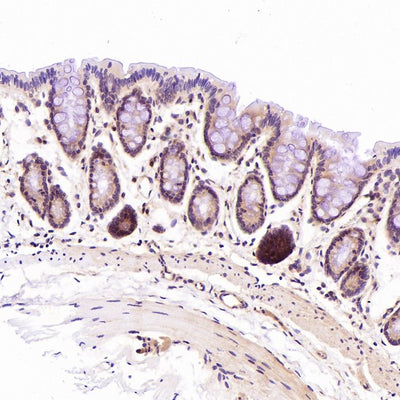 Anti-CD45 PTPRC Rabbit Monoclonal Antibody Boster Bio