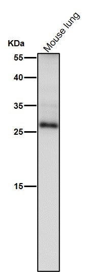 Anti-TIMP1 Rabbit Monoclonal Antibody Boster Bio