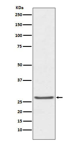 Anti-TIMP1 Rabbit Monoclonal Antibody Boster Bio