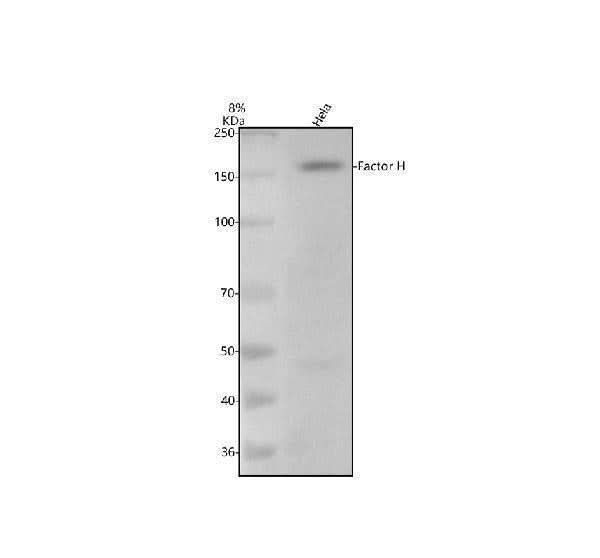 Anti-Factor H CFH Monoclonal Antibody Boster Bio