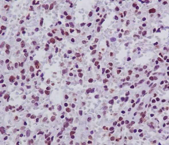 Anti-FANCD2 Rabbit Monoclonal Antibody Boster Bio