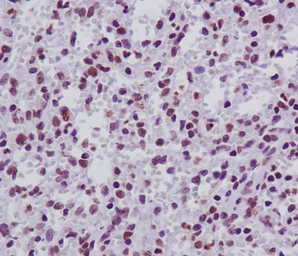 Anti-FANCD2 Rabbit Monoclonal Antibody Boster Bio
