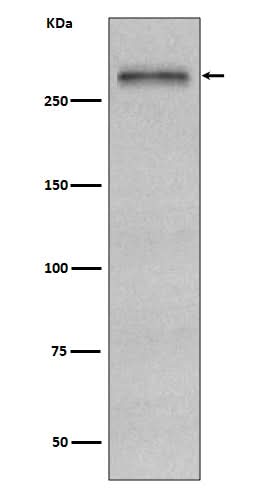 Anti-Fibronectin FN1 Rabbit Monoclonal Antibody Boster Bio
