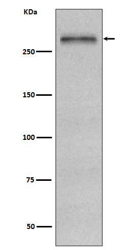 Anti-Fibronectin FN1 Rabbit Monoclonal Antibody Boster Bio