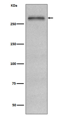 Anti-Fibronectin FN1 Rabbit Monoclonal Antibody Boster Bio