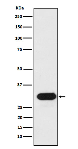 Anti-HLA-Drb1 Monoclonal Antibody Boster Bio