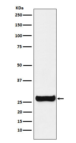 Anti-GSTM1 Rabbit Monoclonal Antibody Boster Bio