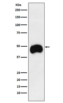 Anti-CD2 Monoclonal Antibody Boster Bio