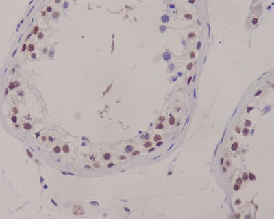 Anti-XRCC1 Rabbit Monoclonal Antibody Boster Bio