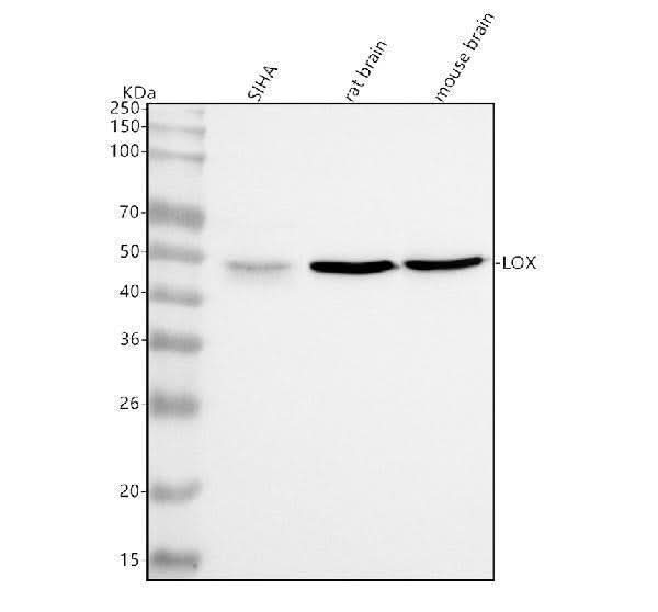 Anti-LOX Rabbit Monoclonal Antibody Boster Bio