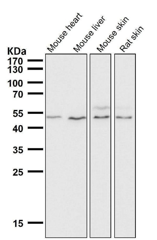 Anti-IRF1 Rabbit Monoclonal Antibody Boster Bio
