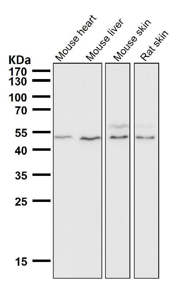 Anti-IRF1 Rabbit Monoclonal Antibody Boster Bio