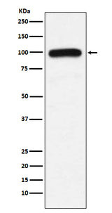 Anti-UBE3A Monoclonal Antibody Boster Bio