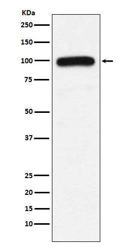 Anti-UBE3A Monoclonal Antibody Boster Bio