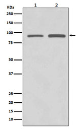 Anti-SUZ12 Rabbit Monoclonal Antibody Boster Bio