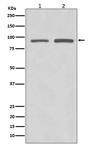 Anti-SUZ12 Rabbit Monoclonal Antibody Boster Bio